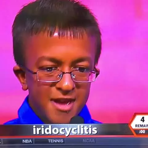 iridocyclitis meme image