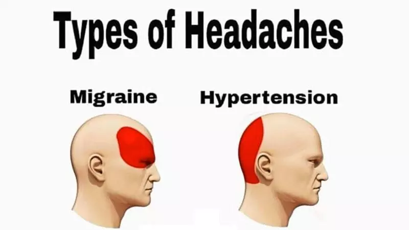 types of headaches meme image